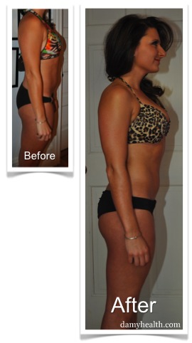 Sarah Before and After DAMY Health Weight Loss Sarah Before and After DAMY Health Weight Loss