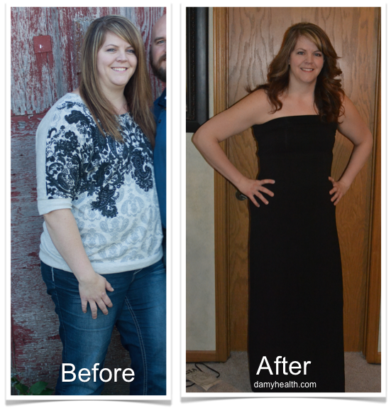 Sara Before and After Testimonial